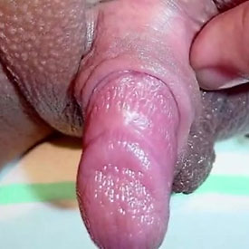 biggest glistening clit